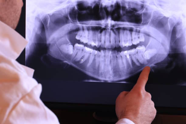 Best Emergency Tooth Extraction in Olive Hill, KY