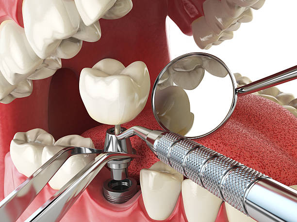 Best Emergency Broken Tooth Repair in Olive Hill, KY